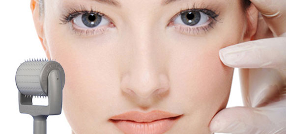 Derma roller, la nouvelle tendance pour votre soin visage